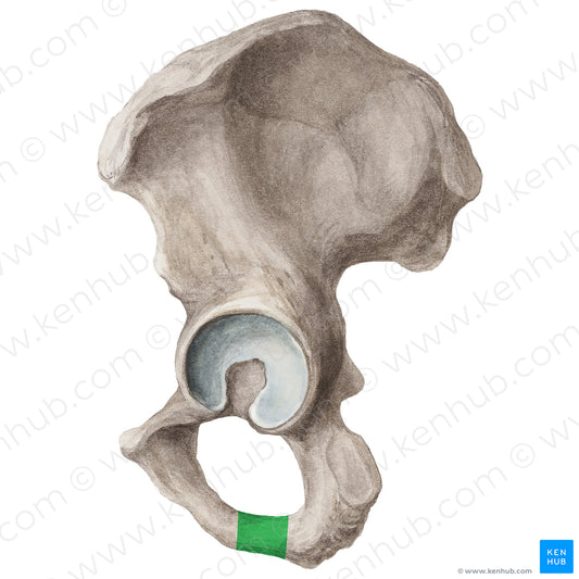 Ramus of ischium (#20281)