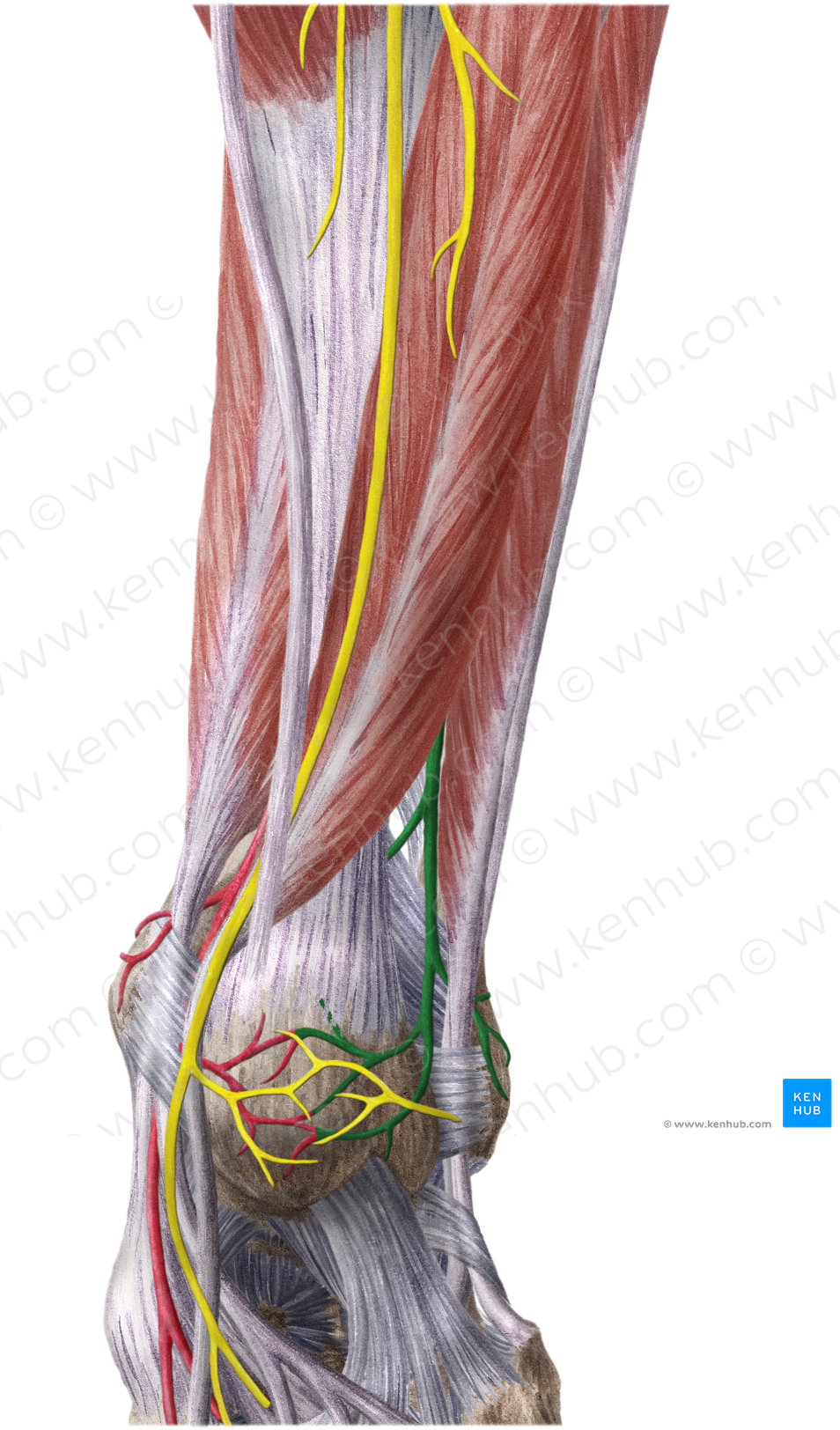 Fibular artery (#1626)