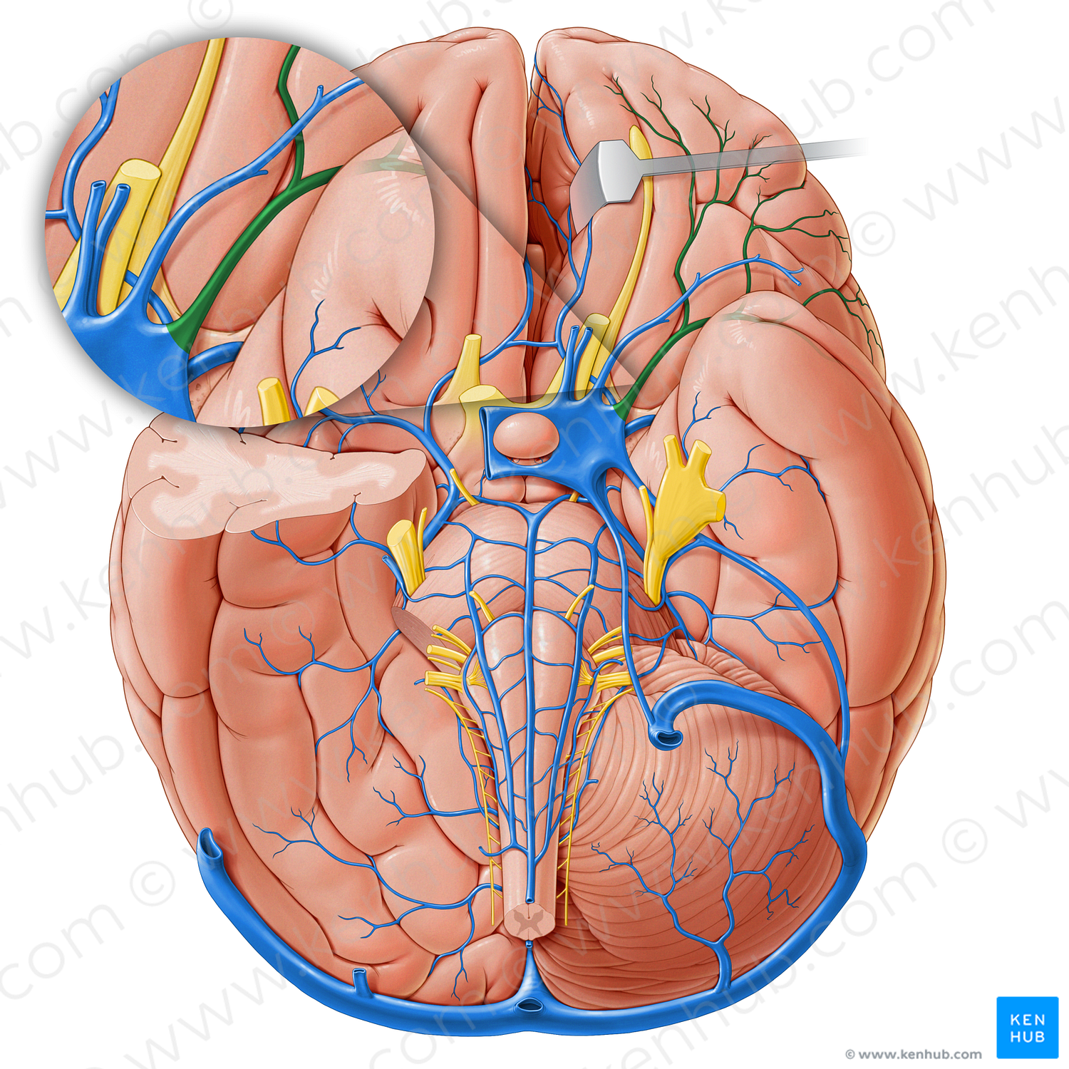 Superficial middle cerebral vein (#18238)