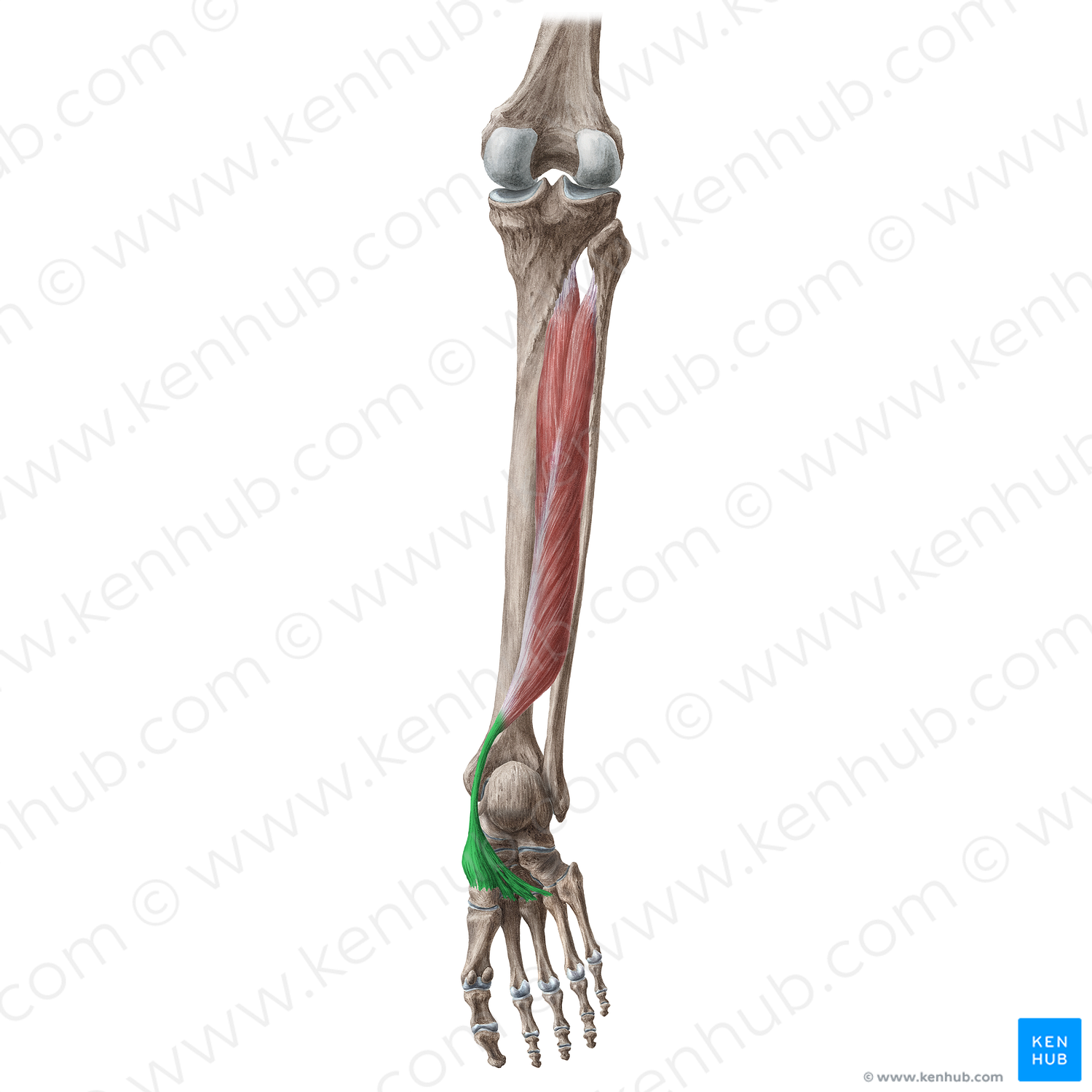 Tendon of tibialis posterior muscle (#17212)