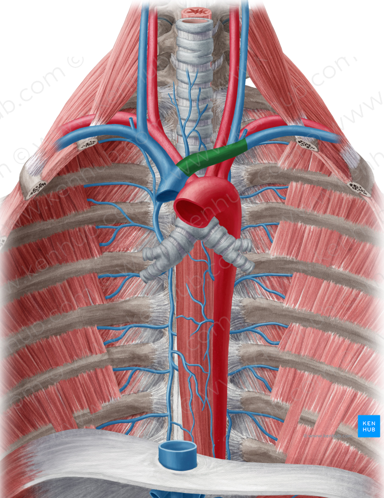 Left brachiocephalic vein (#10014)