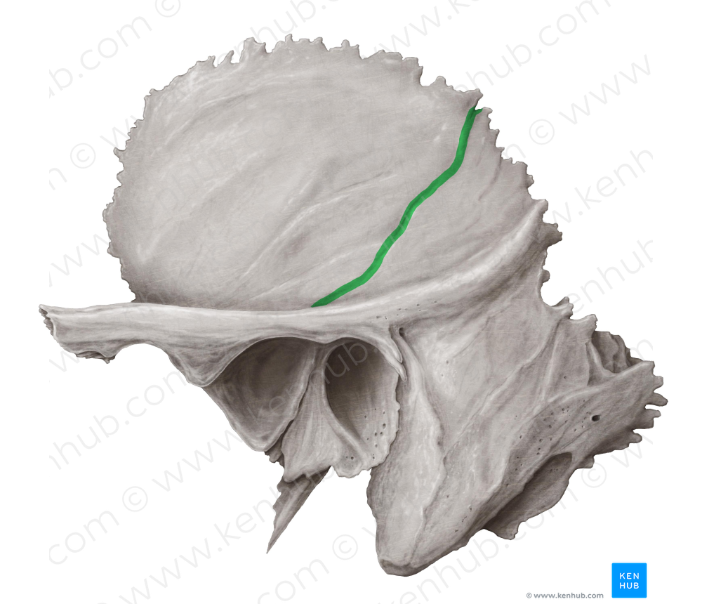Groove for middle temporal artery of temporal bone (#9225)