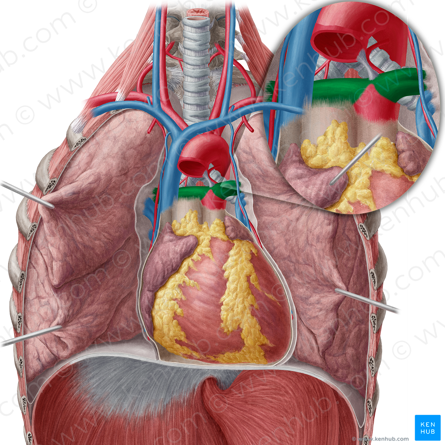 Pulmonary artery (#11597)