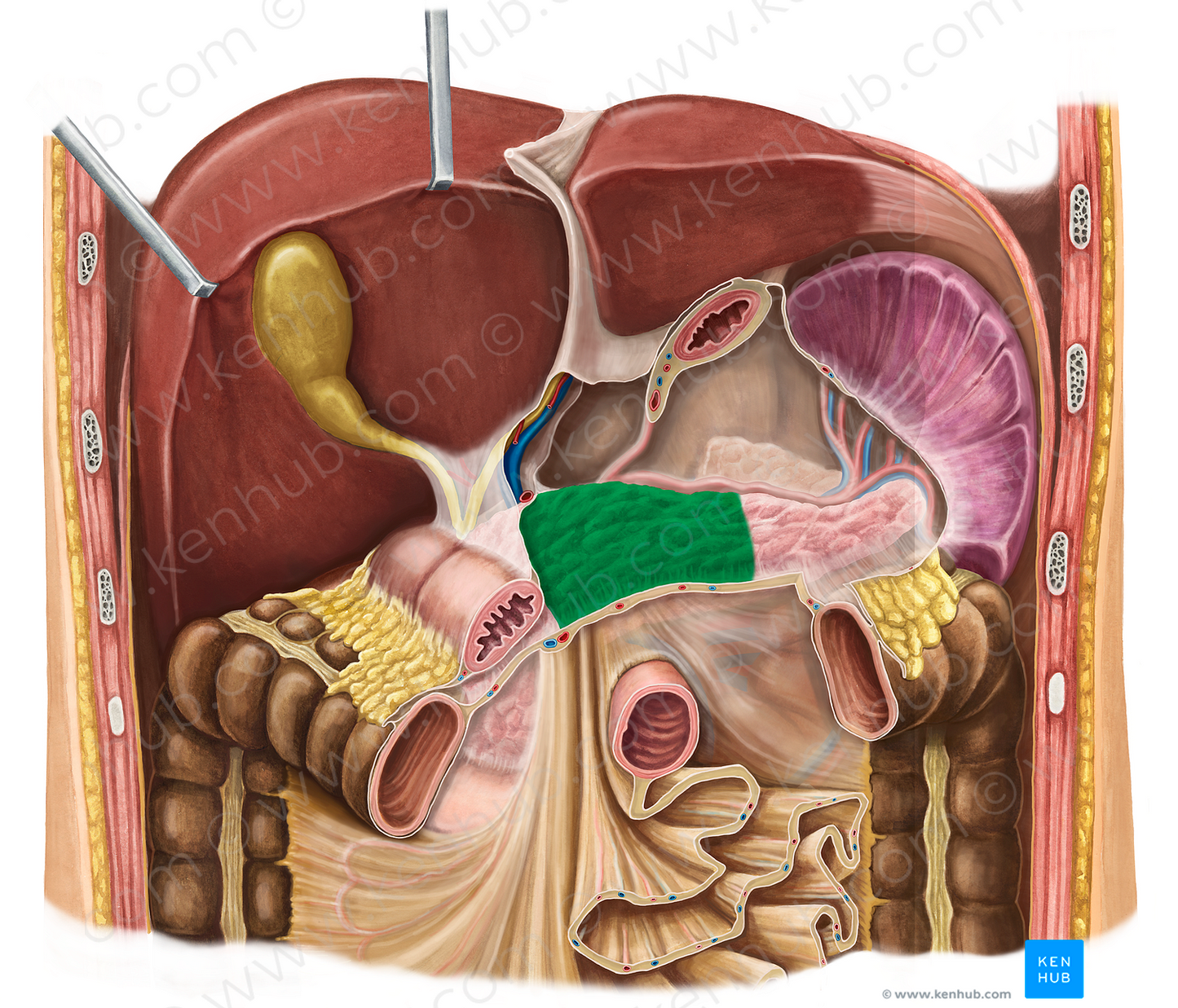Body of pancreas (#2990)