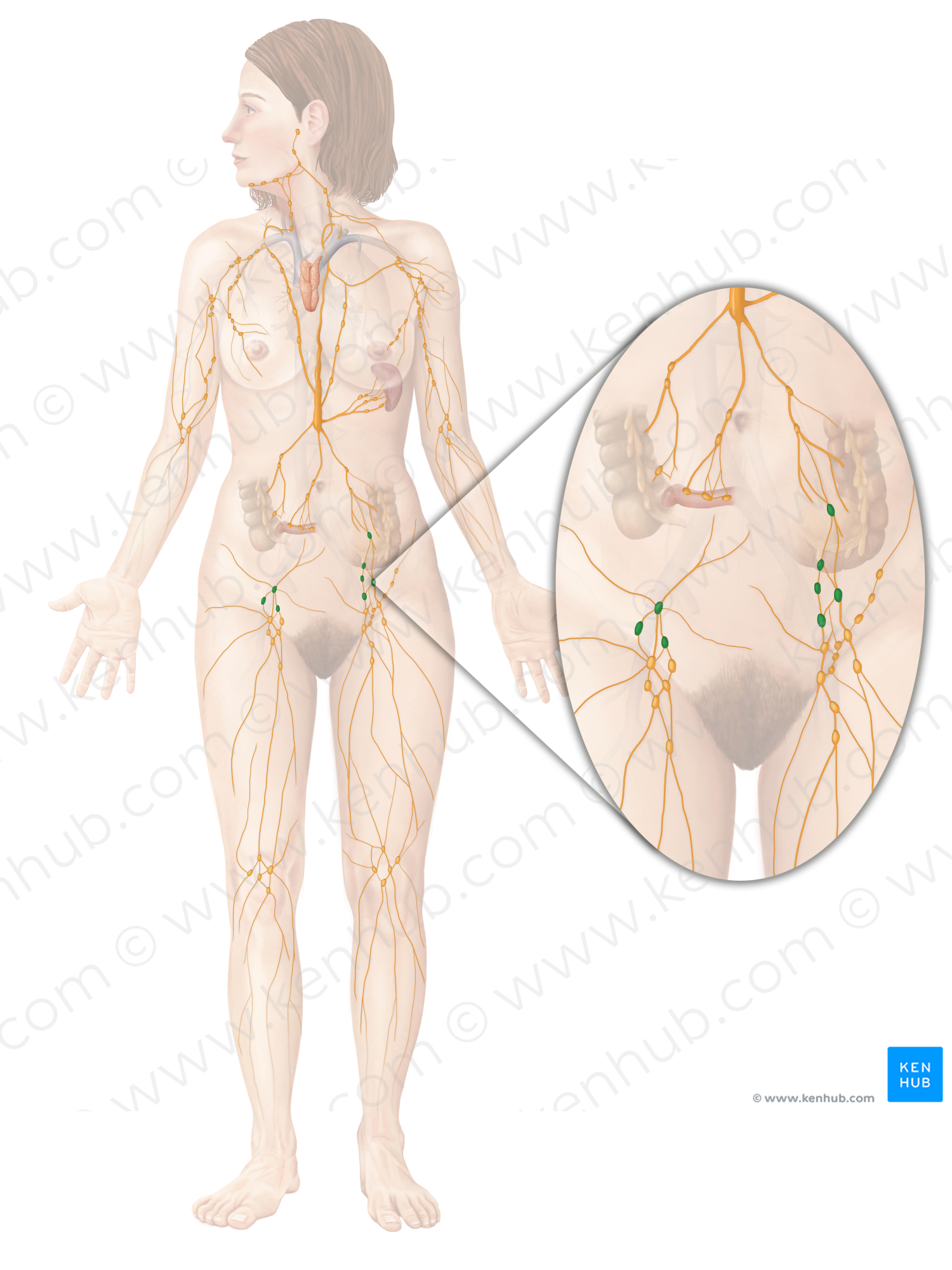 Iliac lymph nodes (#7010)