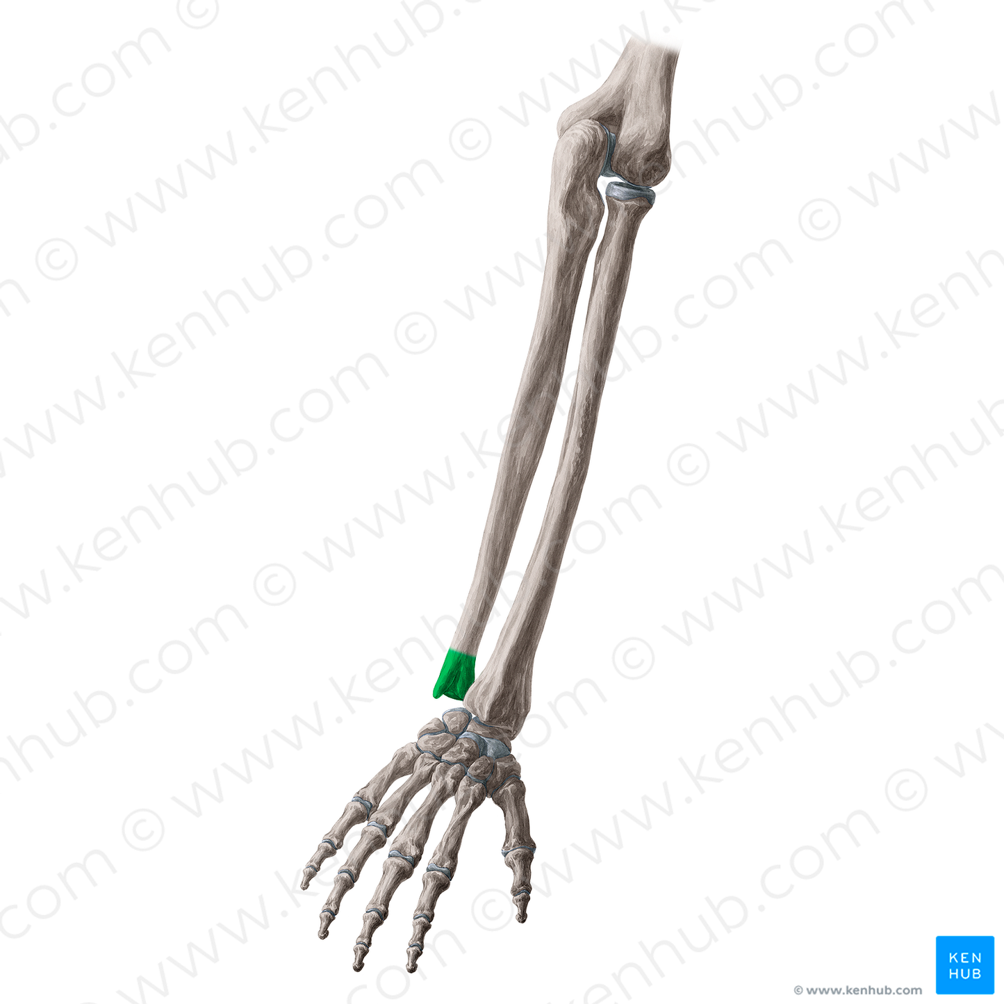 Head of ulna (#21346)