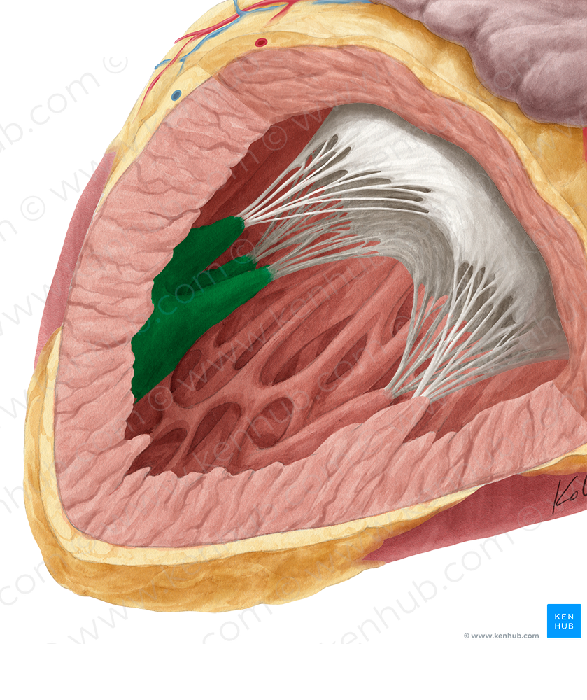 Superior papillary muscle of left ventricle (#5710)