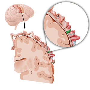 Sensory cortex of chin (#11038)