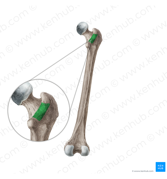 Intertrochanteric crest of femur (#19954)