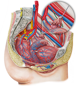 Left superior vesical artery (#1990)