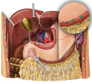 Right gastroomental lymph nodes (#7000)