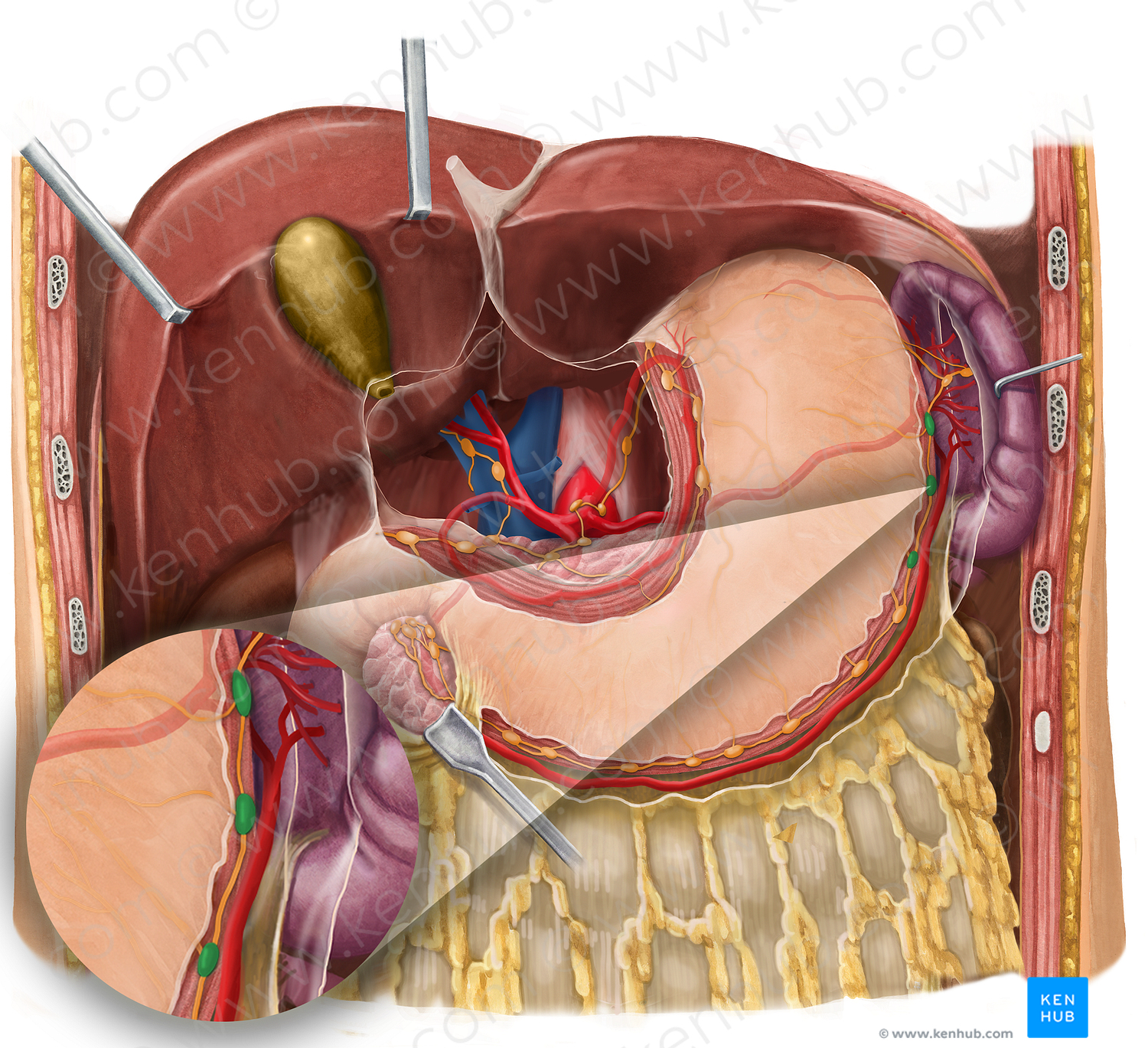 Left gastroomental lymph nodes (#7002)