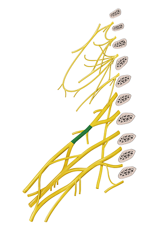 Superior trunk of brachial plexus (#9641)