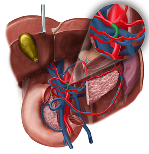 Gastroduodenal artery (#1299)