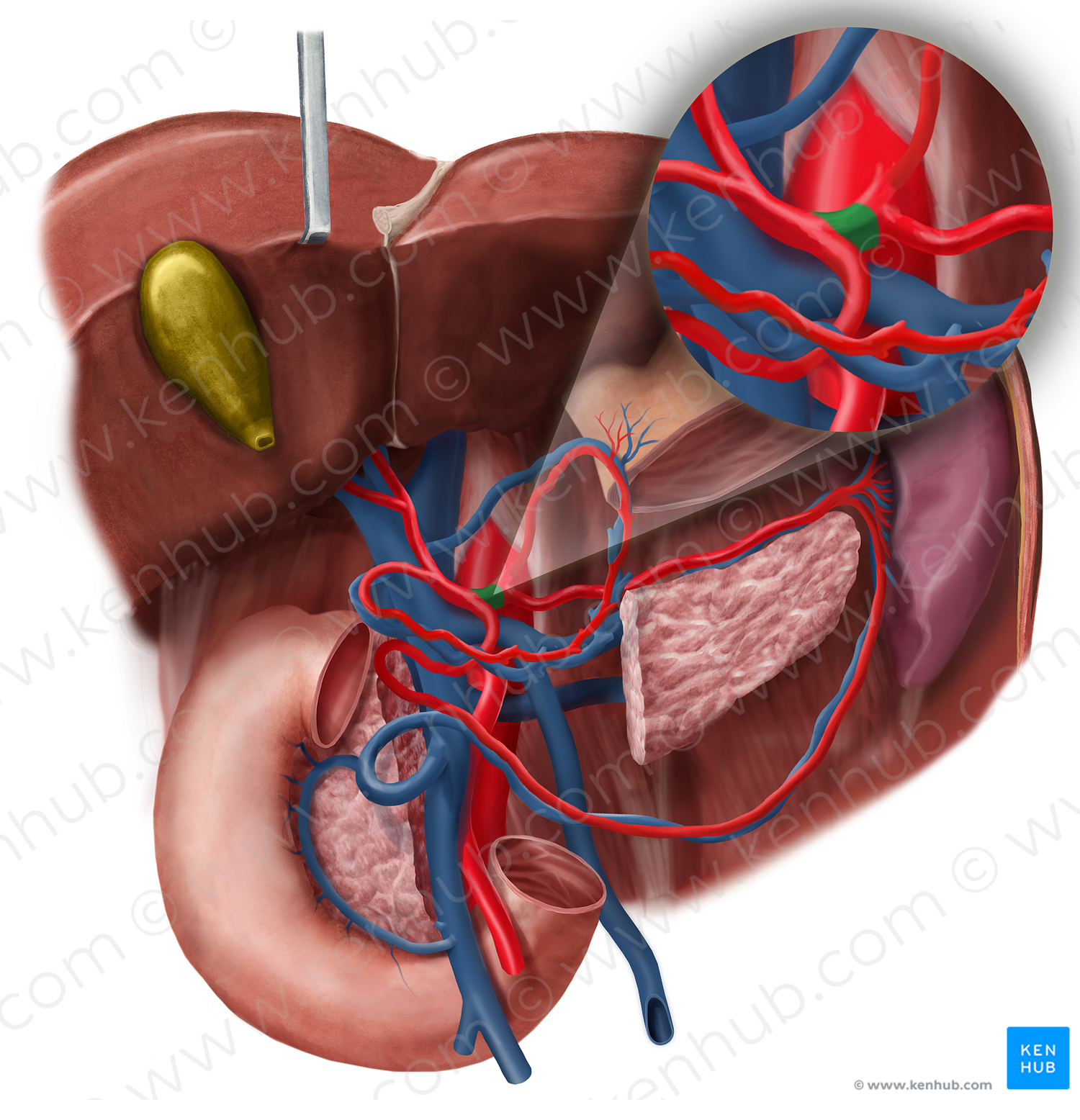 Common hepatic artery (#1333)