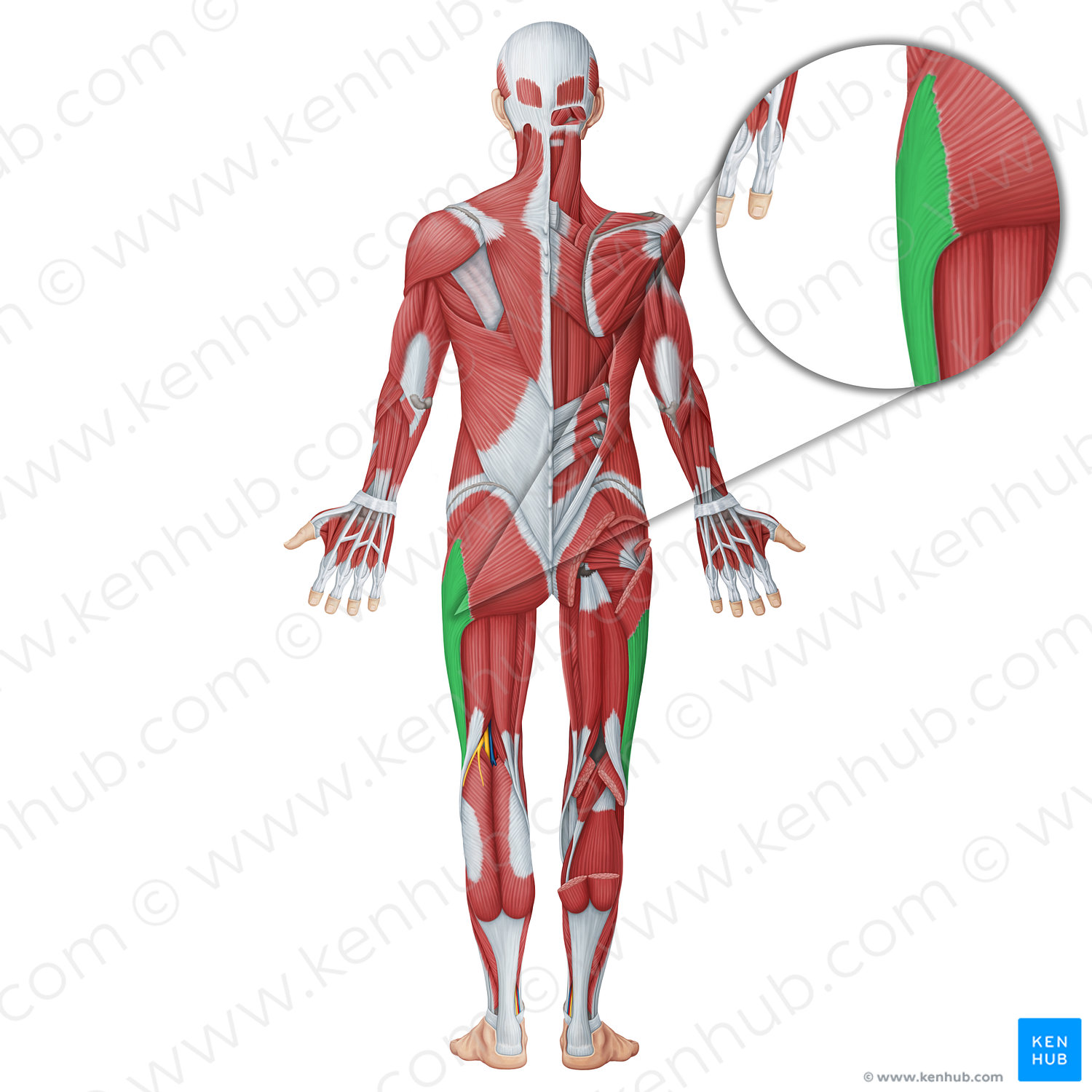 Iliotibial tract (#18691)