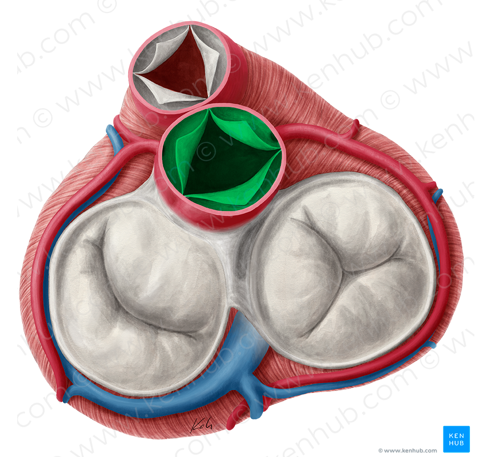 Aortic valve (#9898)