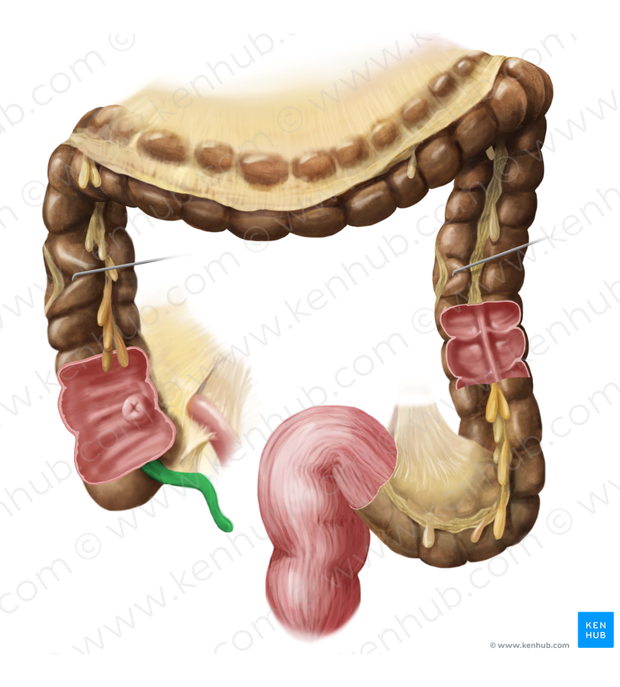 Vermiform appendix (#795)