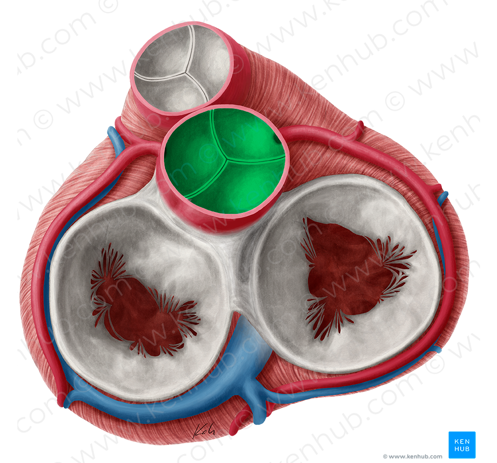 Aortic valve (#9895)