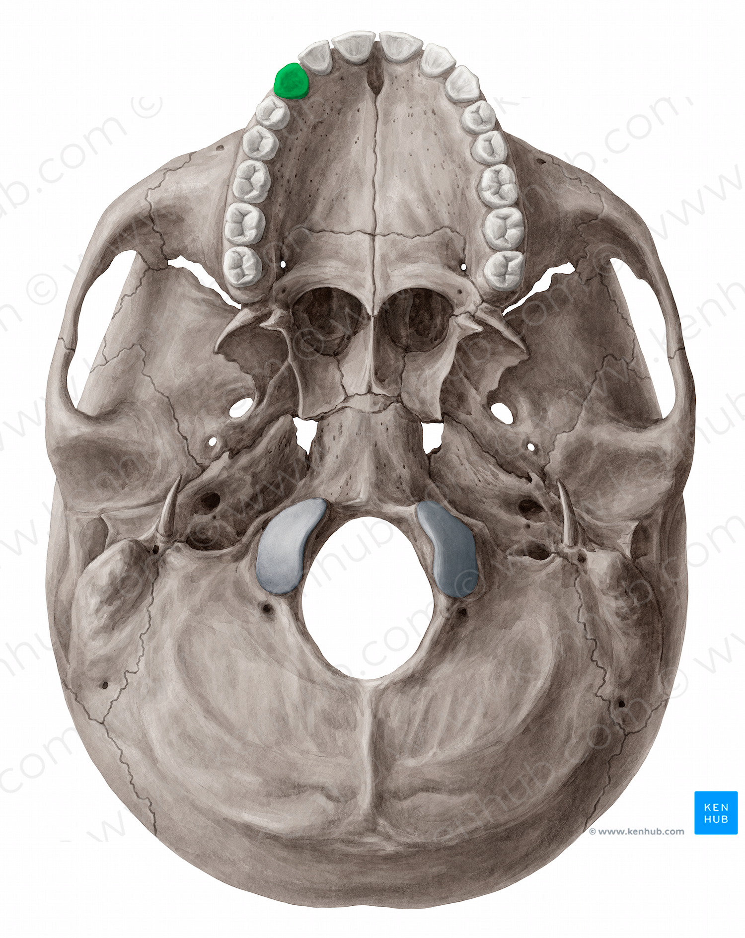 Maxillary right canine tooth (#12831)