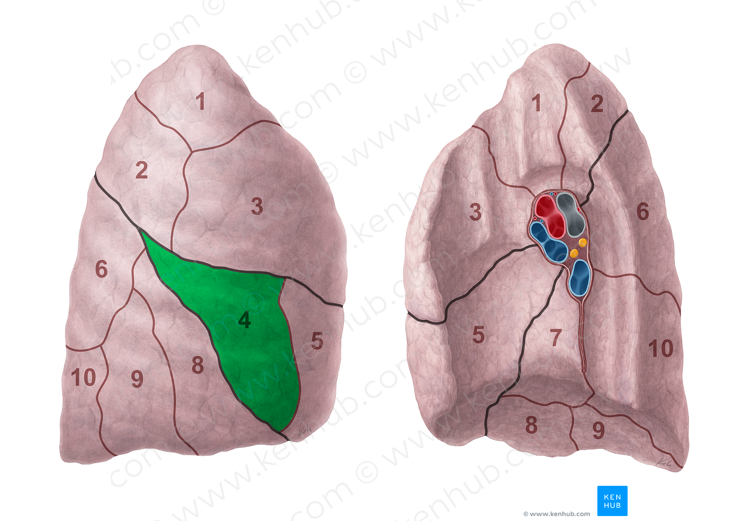 Lateral segment of right lung (#20691)