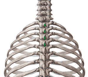 Spinous processes of vertebrae T1-T4 (#8269)