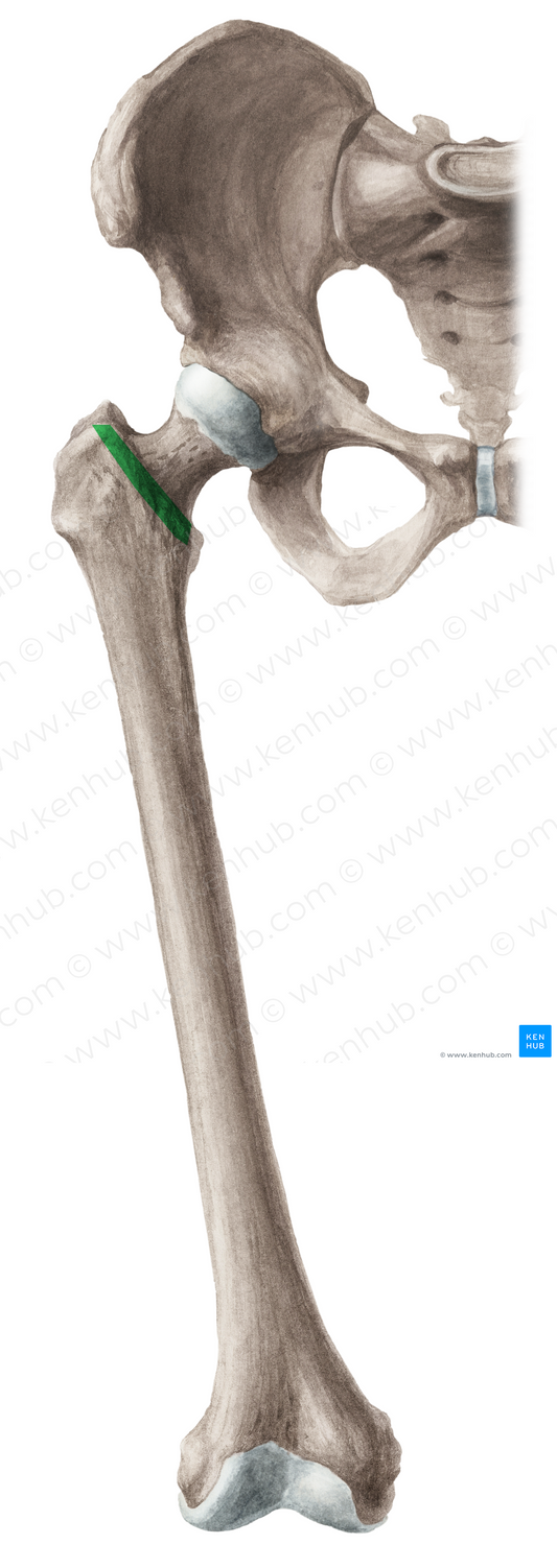 Intertrochanteric line of femur (#4703)