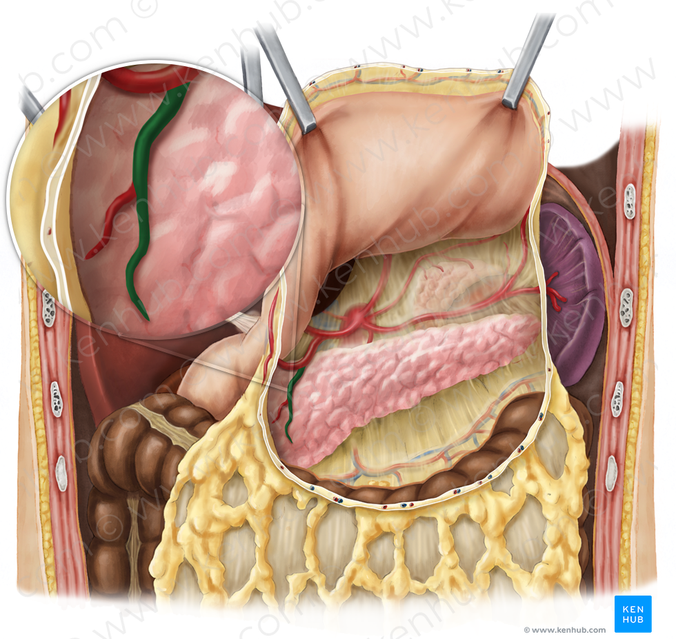 Anterior superior pancreaticoduodenal artery (#1600)