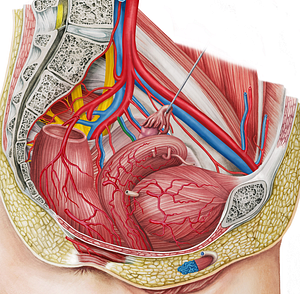 Left inferior vesical artery (#1984)