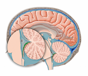 Choroid plexus of fourth ventricle (#12073)