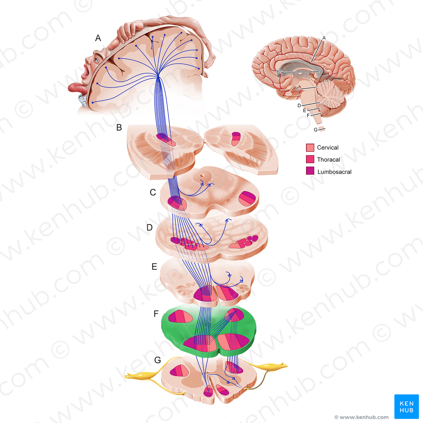 Inferior medulla oblongata (#11215)