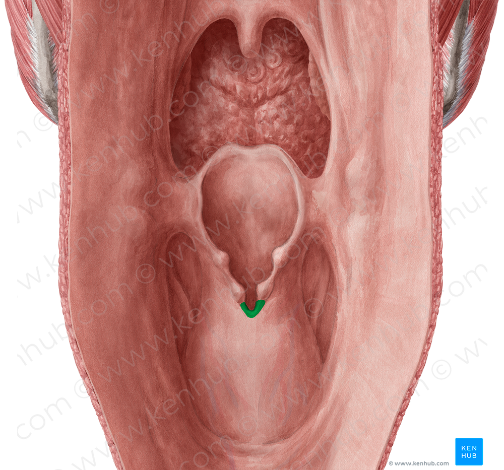 Interarytenoid notch (#4289)
