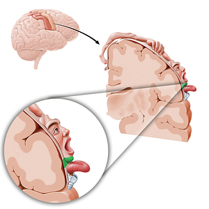 Motor cortex of chin (#11069)