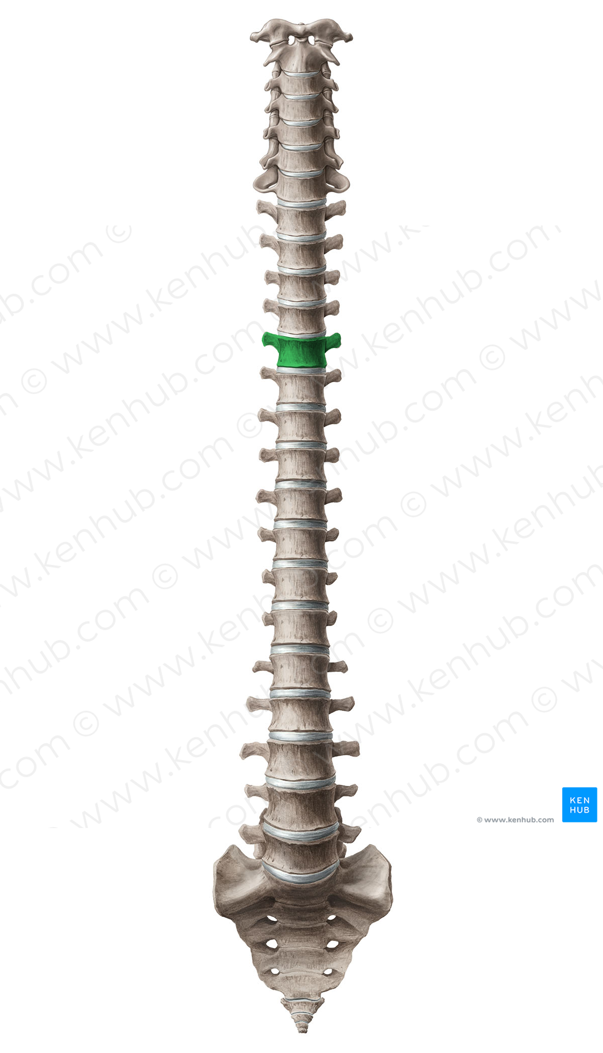 Vertebra T5 (#12589)