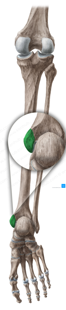 Medial malleolus of tibia (#4894)