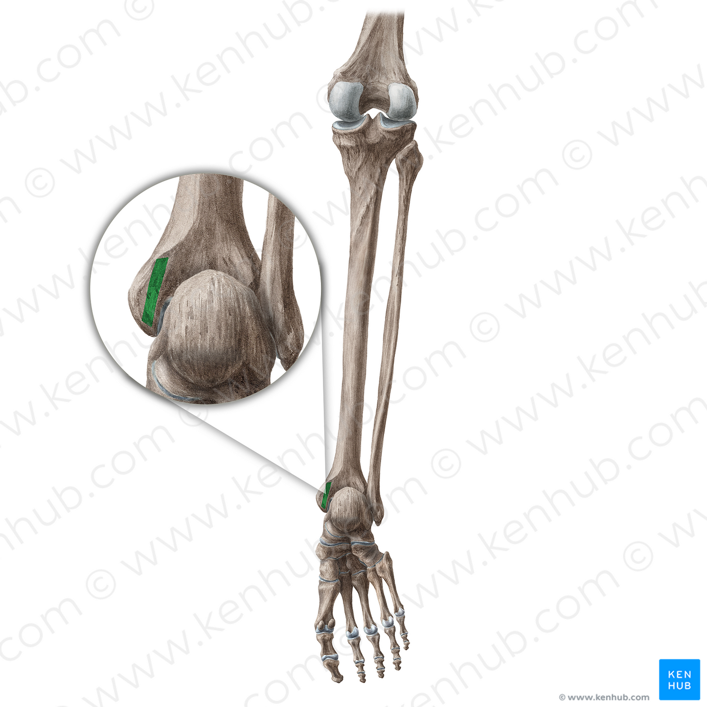 Malleolar groove of tibia (#20446)