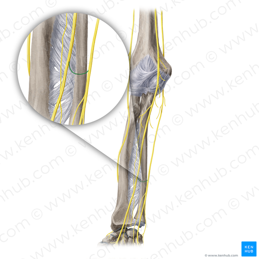 Communicating branch of median nerve with ulnar nerve (#20408)