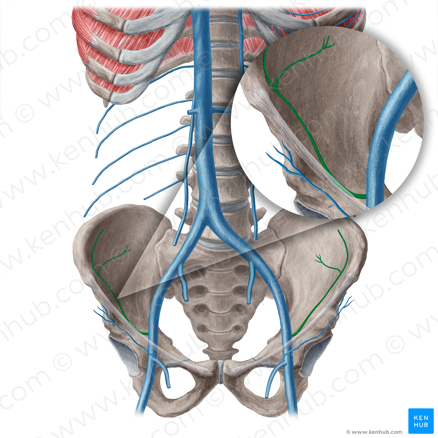 Deep circumflex iliac vein (#21550)