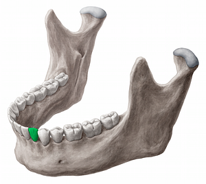 Mandibular left canine tooth (#12847)