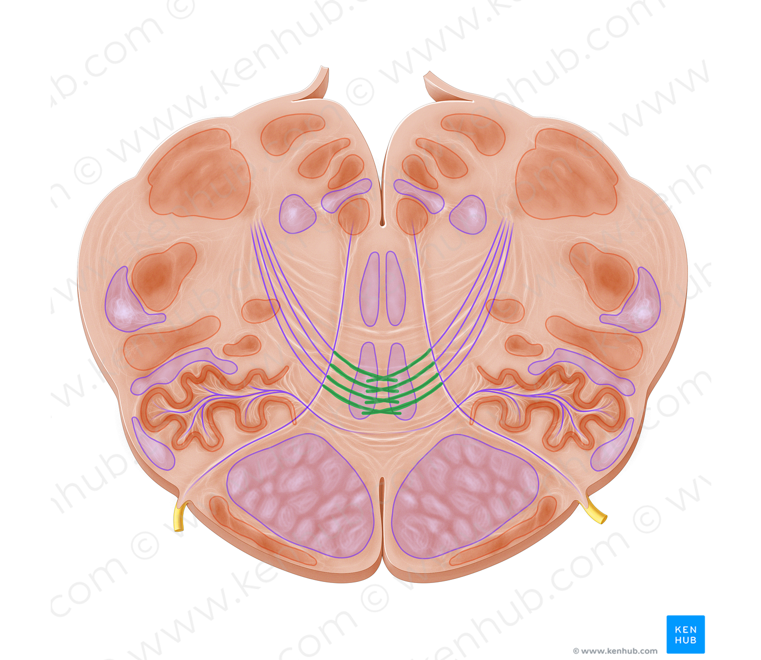 Decussation of medial lemniscus (#21352)