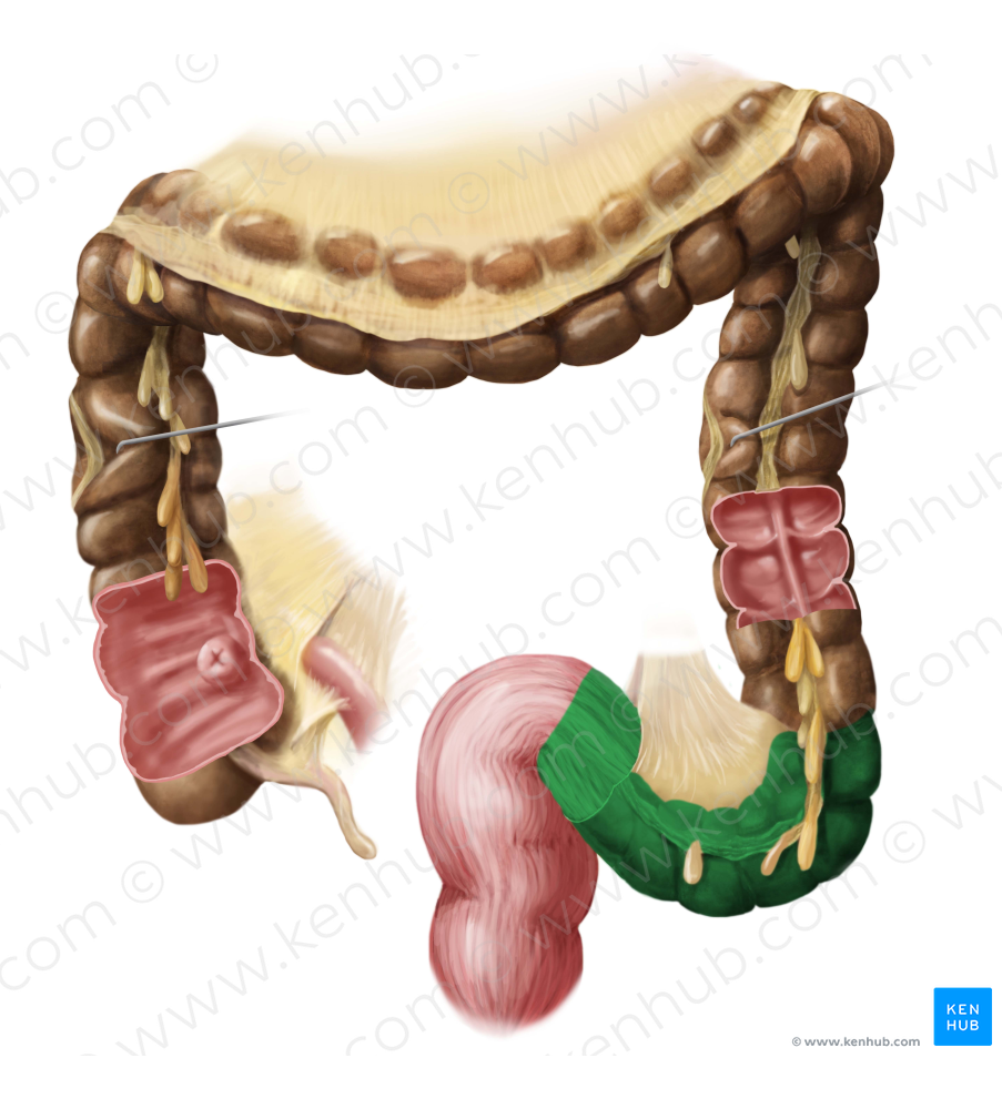 Sigmoid colon (#2743)