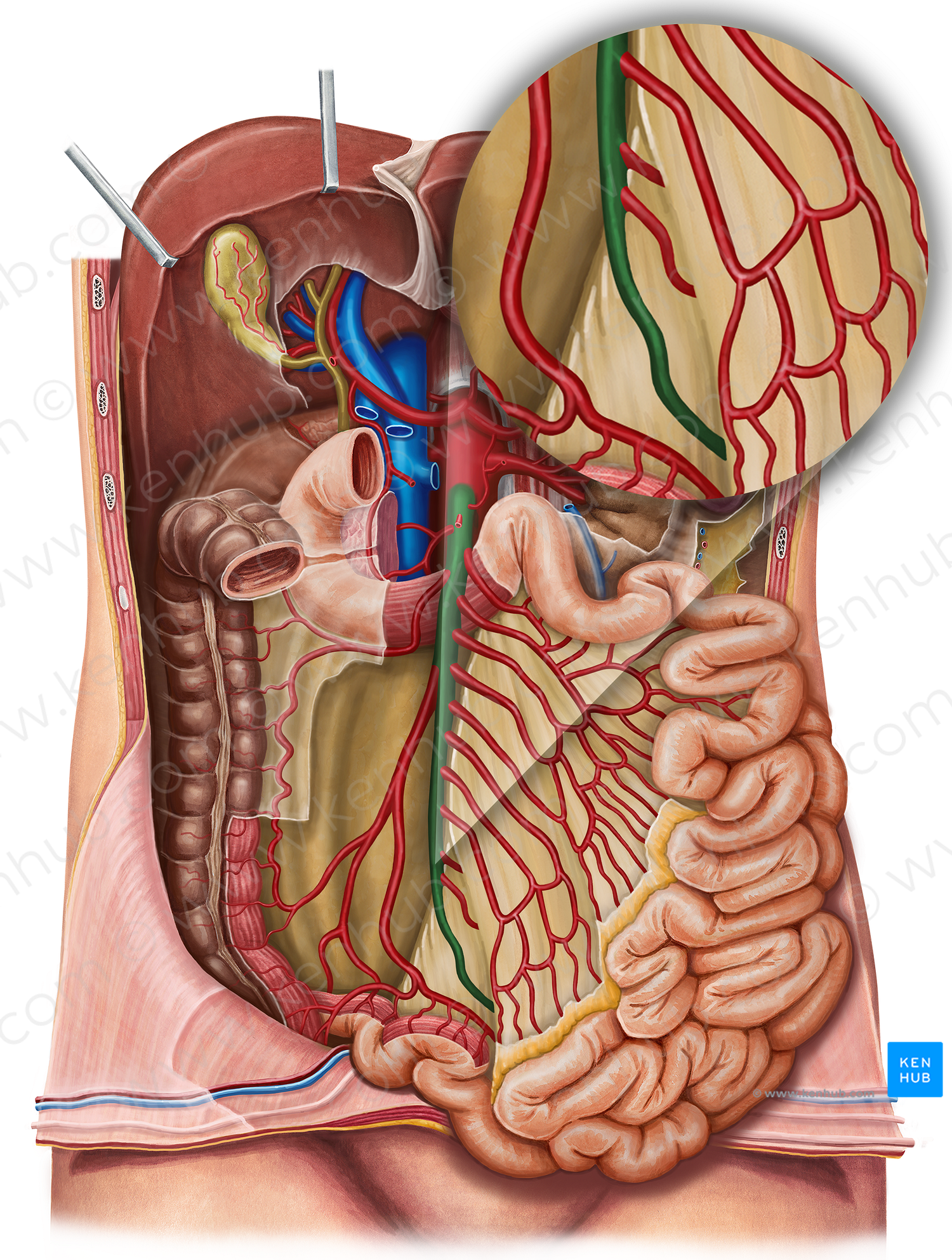 Superior mesenteric artery (#1540)