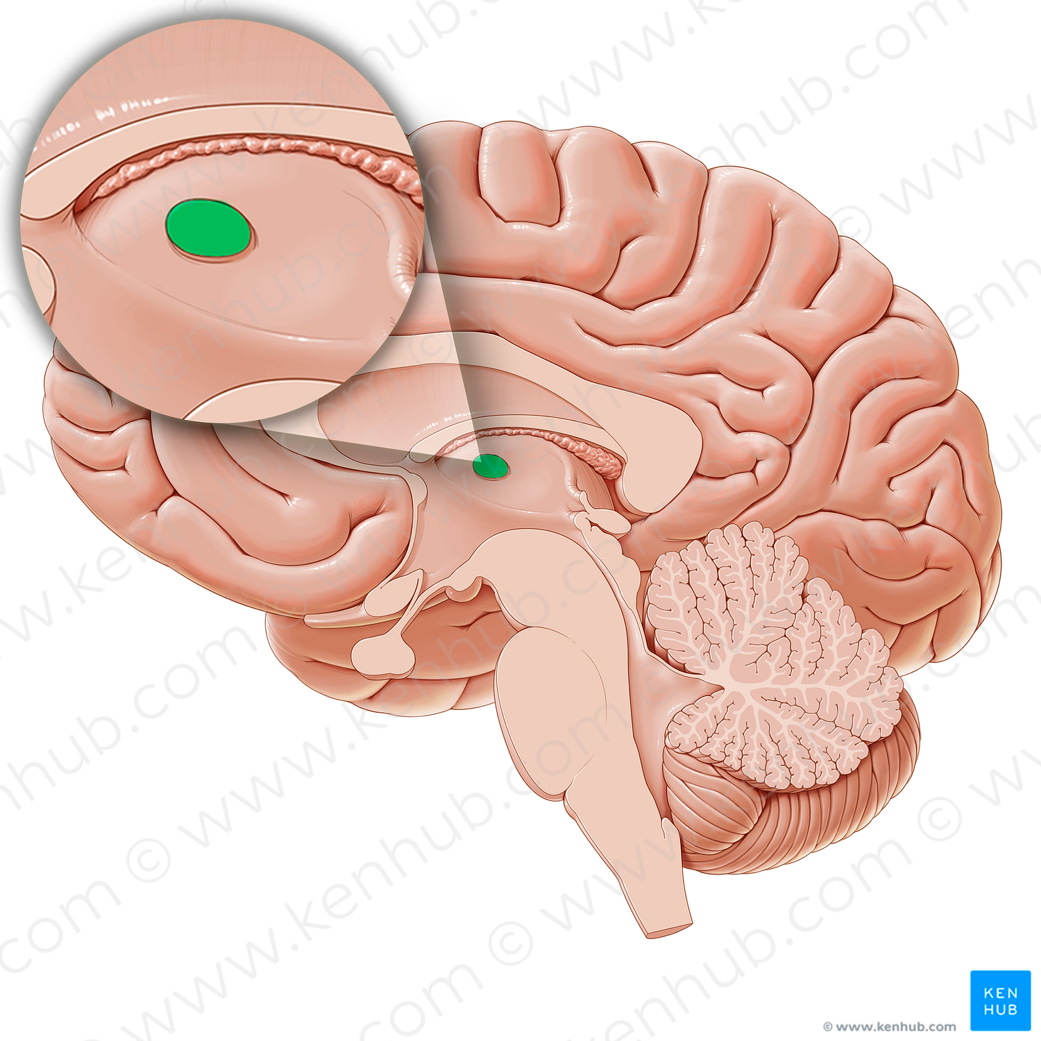 Interthalamic adhesion (#21238)