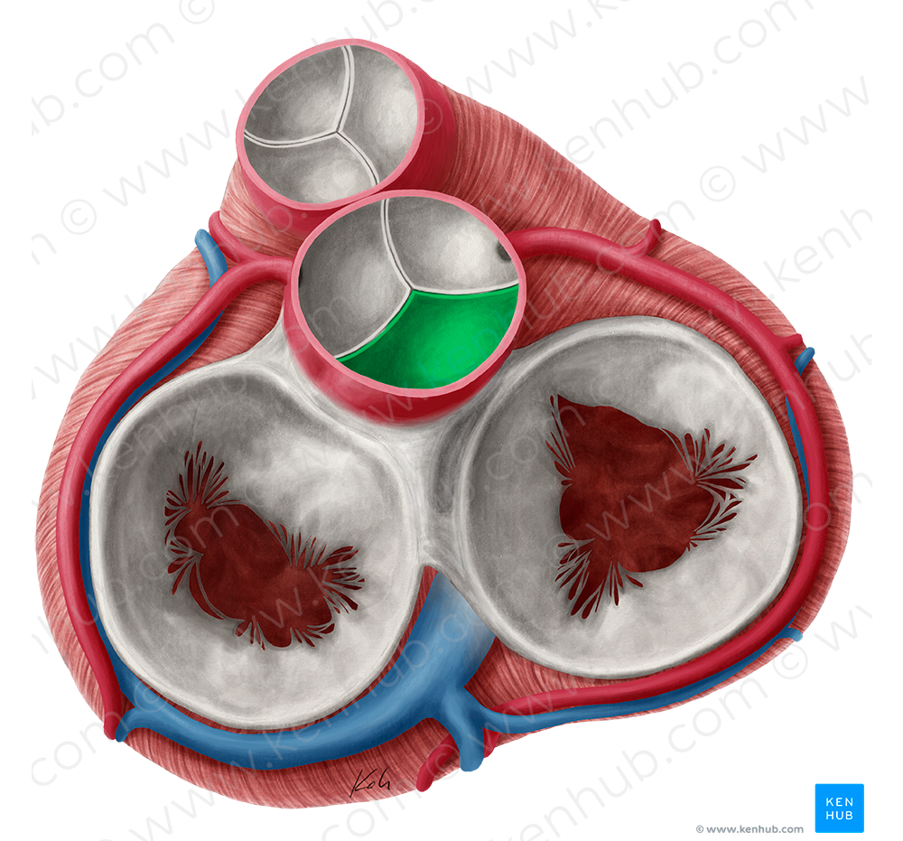 Noncoronary leaflet of aortic valve (#9924)