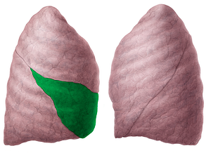 Middle lobe of right lung (#4842)