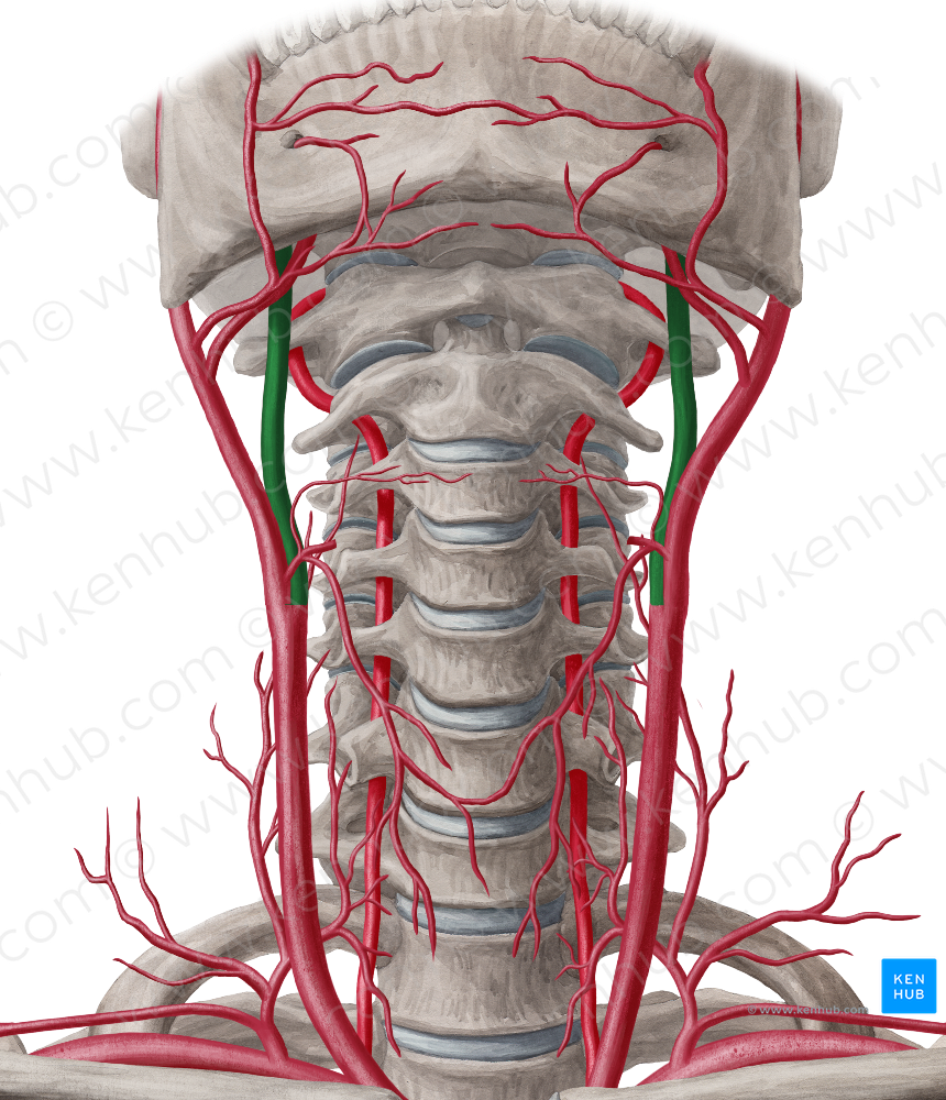 Internal carotid artery (#969)