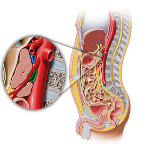 Left renal vein (#17912)