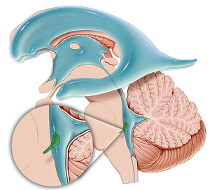 Lateral recess of fourth ventricle (#8846)