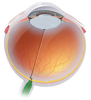 Optic nerve (#6637)