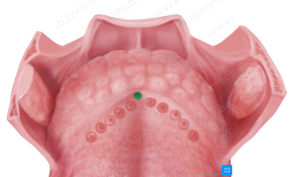 Foramen cecum of tongue (#3730)